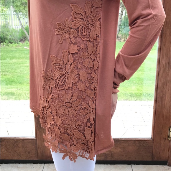 Apricot Flower Lace Patch Detail Tunic - Picture 2 of 5